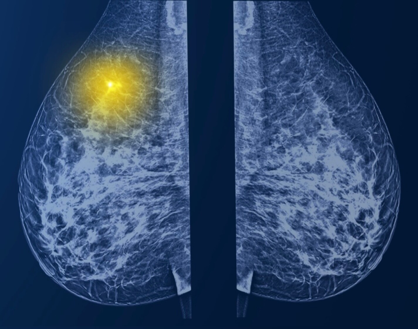 Request a demo Request a demo