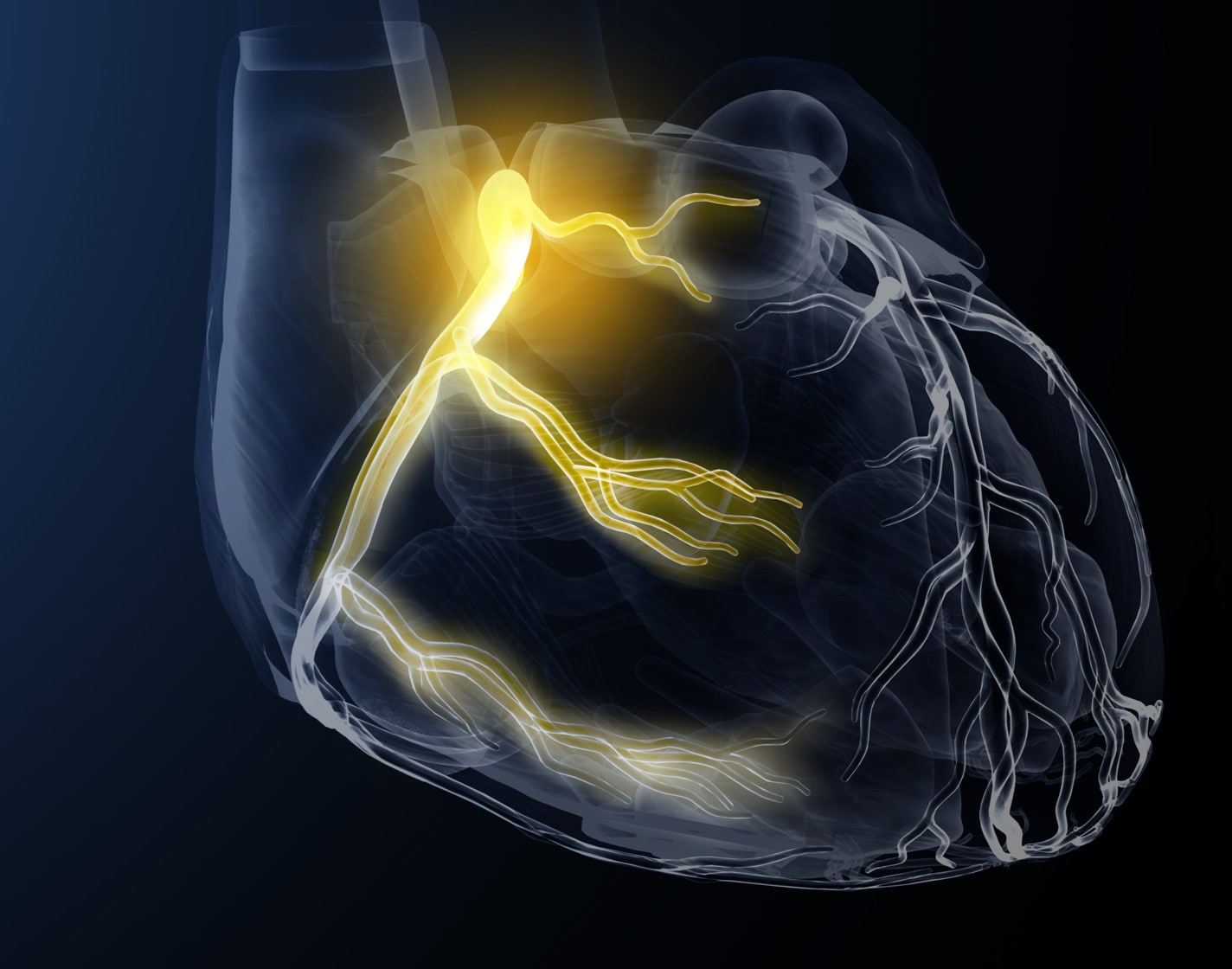 Request a demo Request a demo