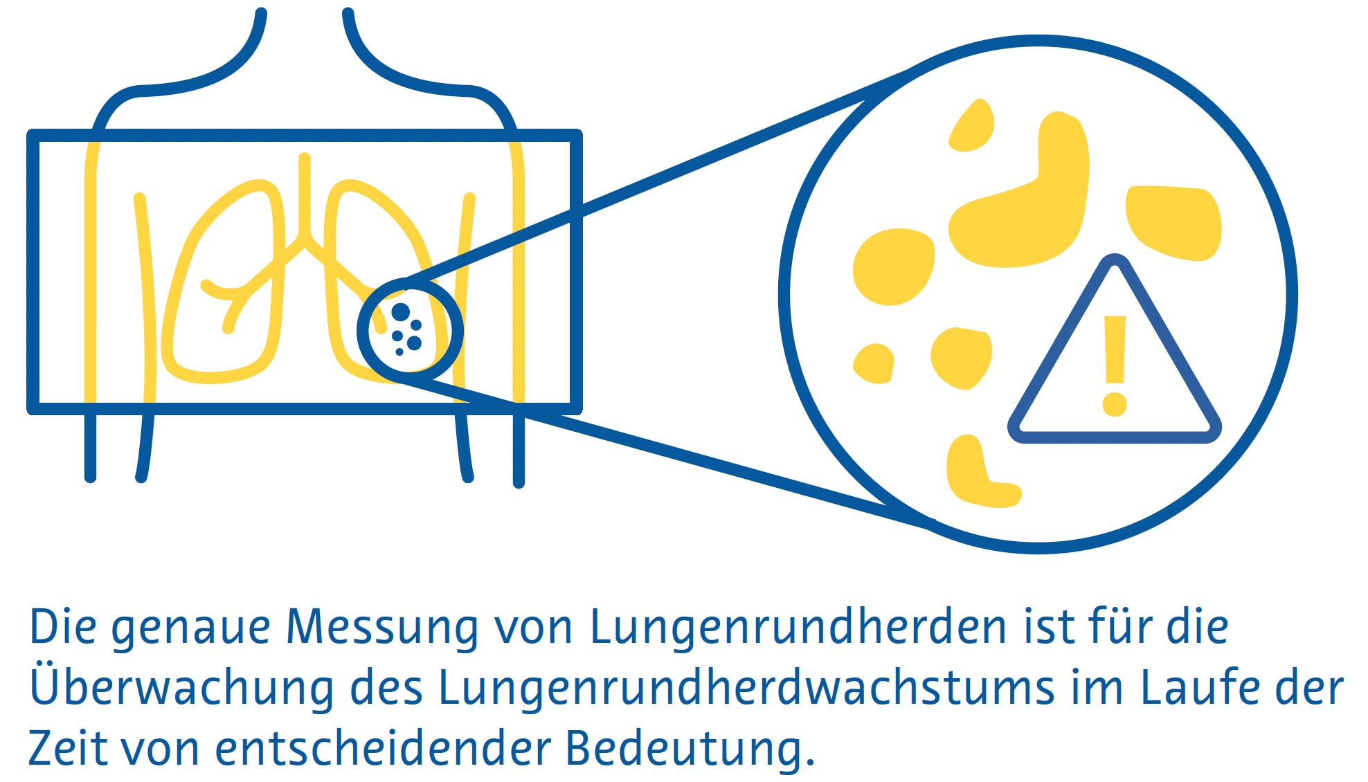 Lungenrundherdsegmentierung Lungenrundherdsegmentierung
