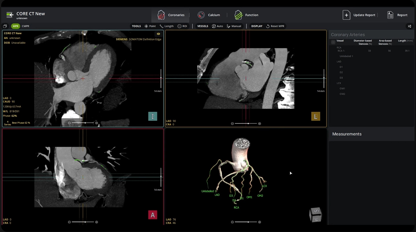 CORE-CT