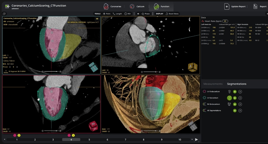 CT Function