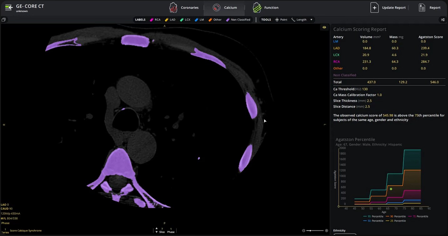 GE-CORE-CT
