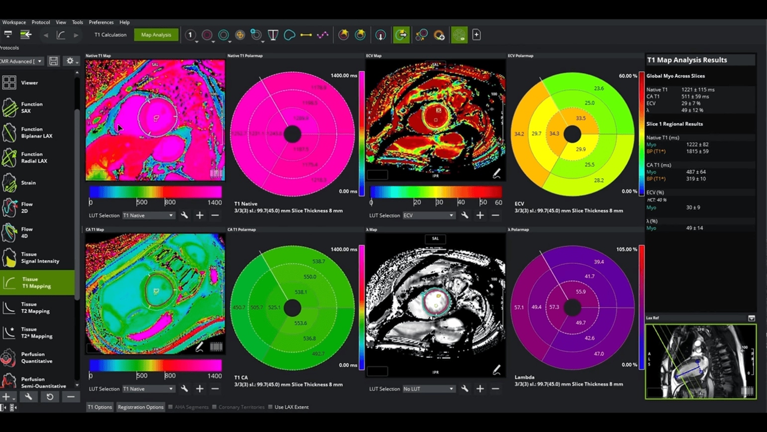 Tissue t1 Mapping