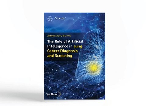 The Role Of Artificial Intelligence in Lung Cancer Diagnosis and Screening