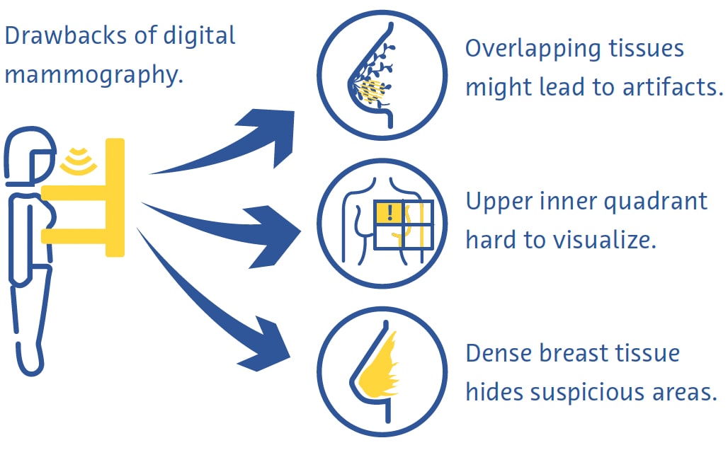Drawbacks of Digital mammography