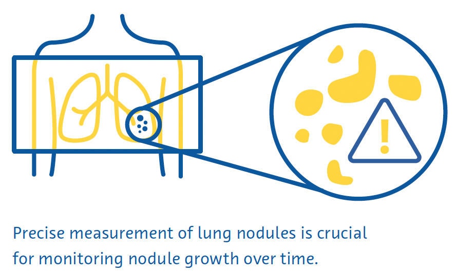 Lung nodule segmentation