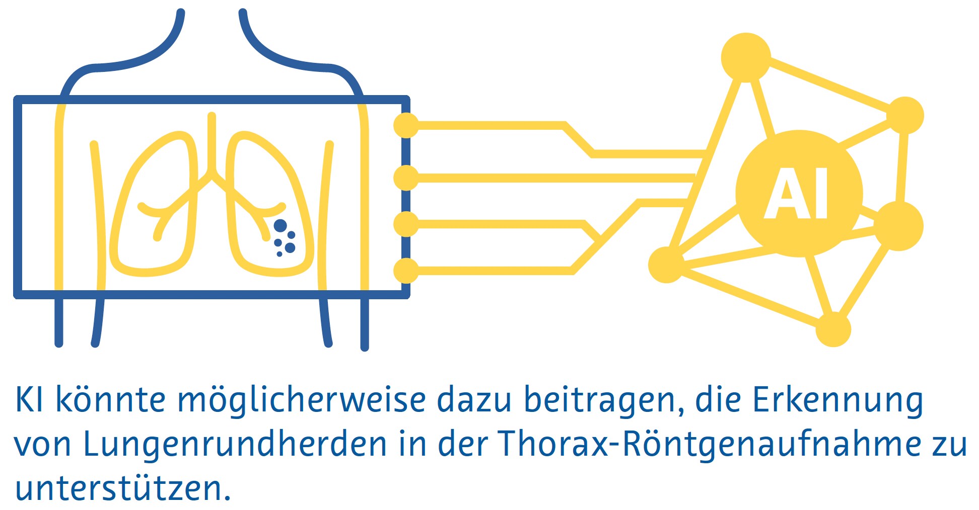 Erkennung von Lungenrundherden