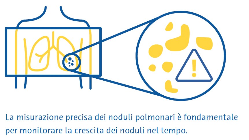 polmonari