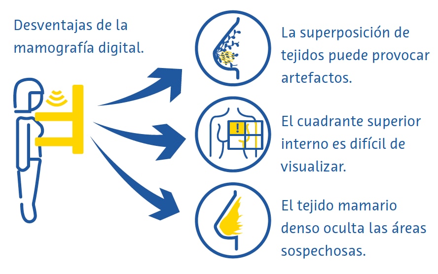 mamografia