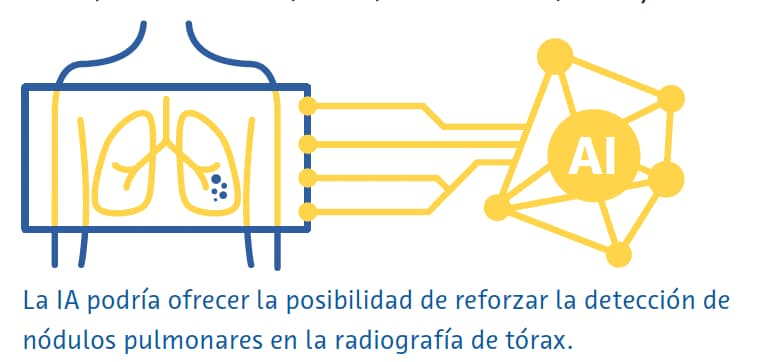 pulmonares