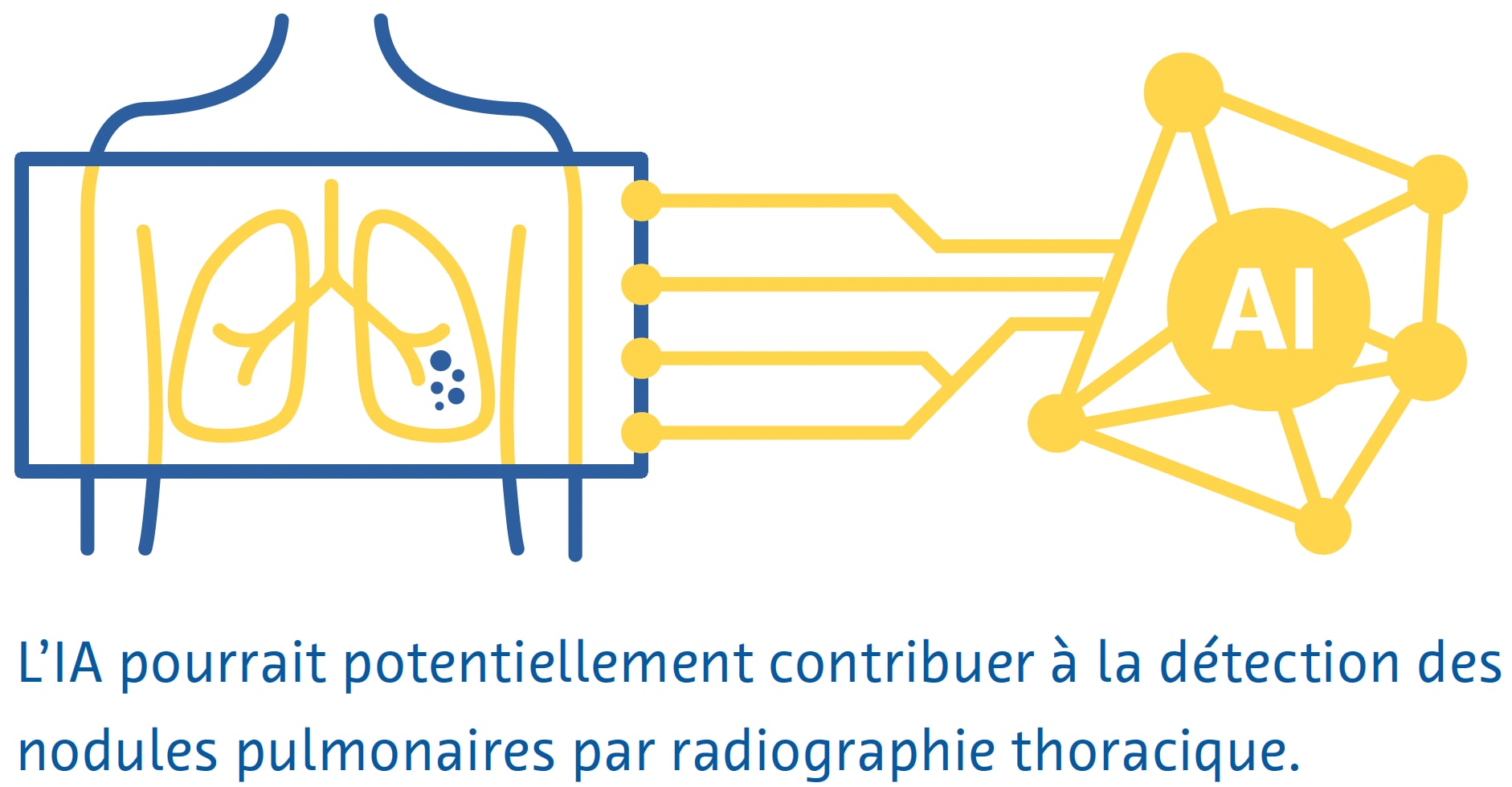 radiographie-thoracique