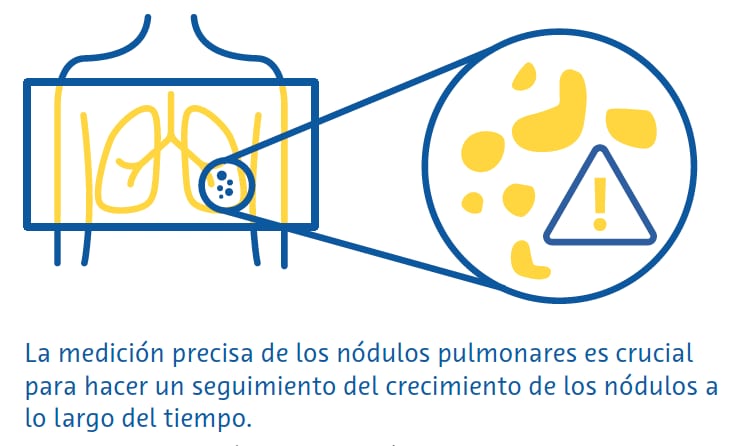 segmentacion
