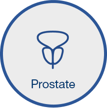 Prostate